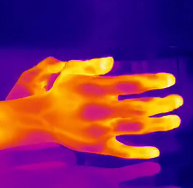 thermal imaging